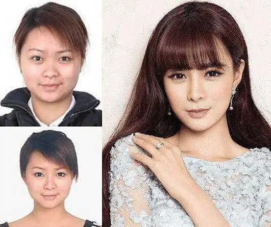 沈梦辰整容前后照片对比鼻子上挺露出鼻孔神撞脸雷震子