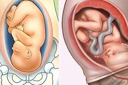 这很正常至于小便频繁,可能与胎儿入盆压迫膀胱有关系,一般妊