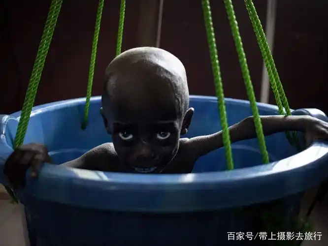 走近世界上婴儿死亡率最高的国家,儿童瘦成皮包骨生不如死活着!
