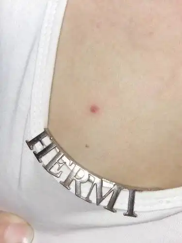 大半年前,我胸前起了一个小红点,有点疼,没有管它,过了一阵子消失