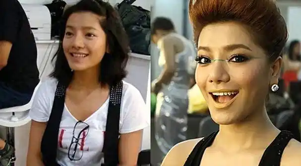 曾超女冠军江映蓉整容失败像怪物全身只剩眼珠是自己的