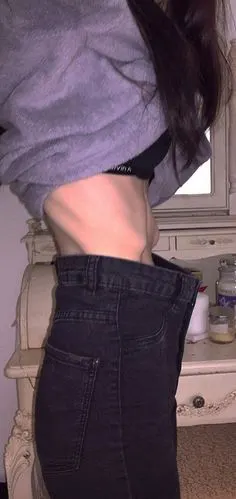 太瘦了19岁女孩骨瘦如柴仍嫌自己胖