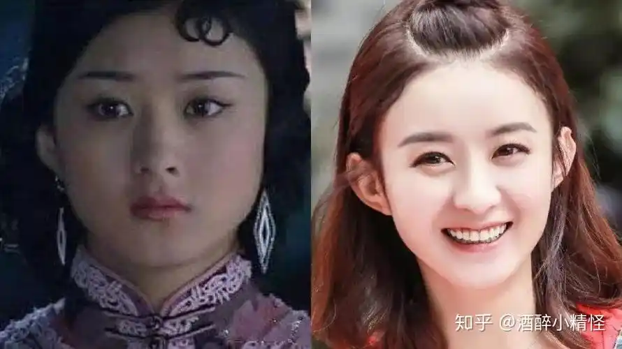 为什么几乎没有人按照赵丽颖的样子整容