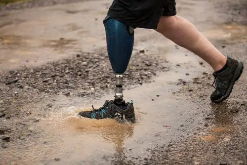 大腿假肢小腿假肢接受腔的保养