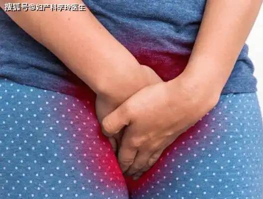 【妇产科李玲主任健康科普】滴虫阴道炎?_患者_现象_外阴