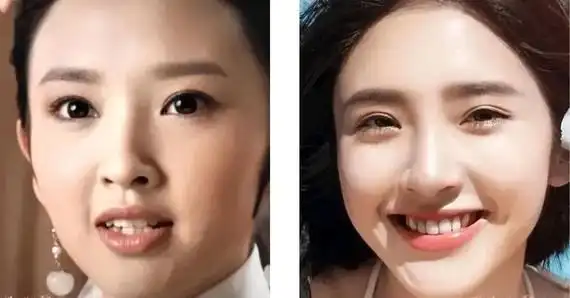 李冰冰整牙后对脸型的改观很大.蒋欣.