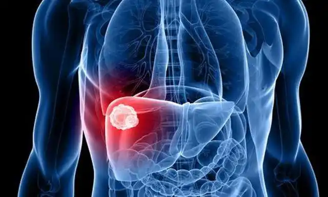 肝部病变牙先知当牙齿有这3种现象时建议平时多喝1茶