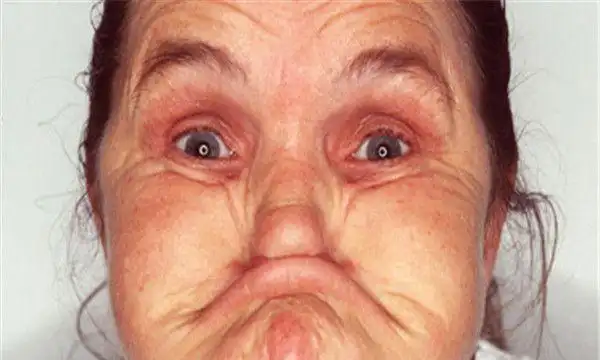 世界上最丑的人排行前五名第一长着鬼脸第三因整容被毁