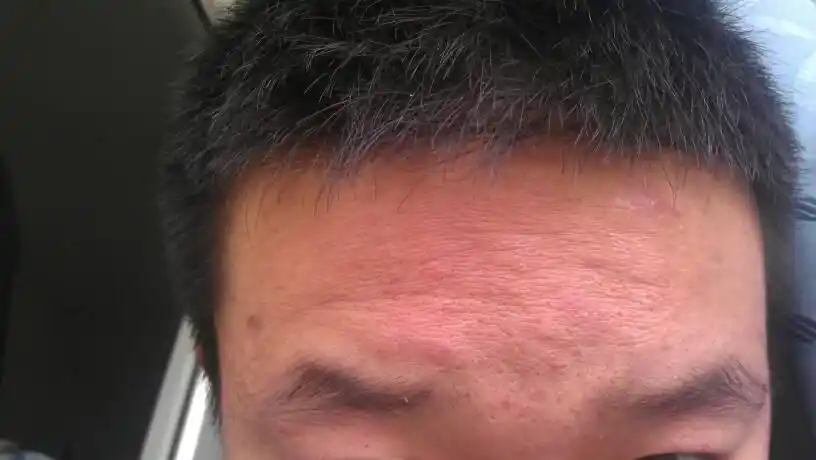 男的,皮肤暗黄无光泽,有衰老现象,额头皮肤松弛,皮肤极其不好,请各位