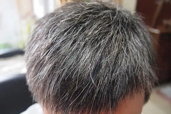 白发疯长怎么办?3款食疗方专治白发__凤凰网