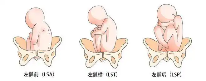 不同胎位的宝宝都是什么样的太可爱了