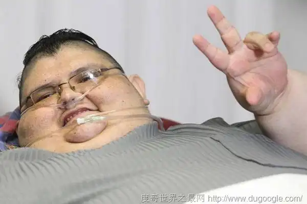 全球最胖的男子体重1000斤,juan pedro franco欲接受手术减肥