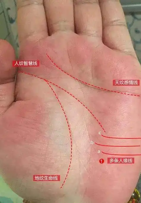 最明显的当属手上的人缘线,人缘线是起始于手掌月丘之掌沿,向掌心发展