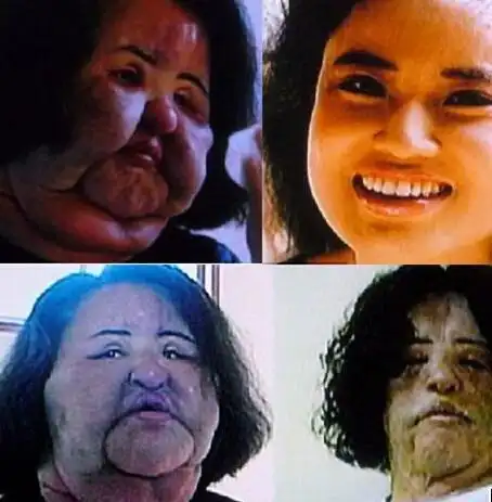 这些女星原本长相倾国倾城,却因整容变毁容一个比一个吓人!_网易订阅