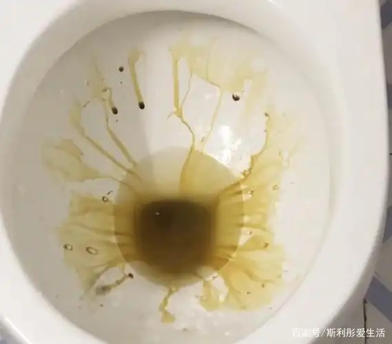 马桶污垢清除不掉怎么办?这个小妙招,轻松解决问题!