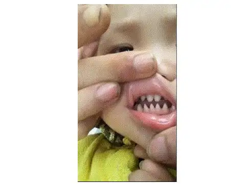 人都是长着齐齐的门牙,而这位小网红,牙都快长齐了,却似乎都是尖牙