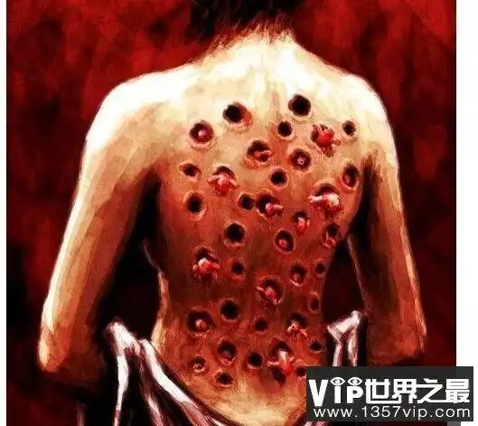 恐怖的玉米男孩图片身上遍布虫洞十分的恶心密集症慎入2