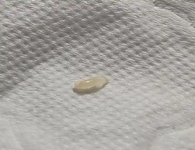 慎入,这个可以蠕动的白色虫子是啥