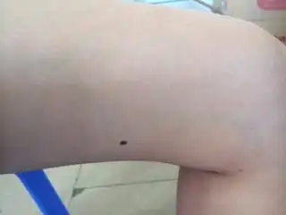 有会算命的吗本人女左边内侧大腿有痣代表什么,好不好?