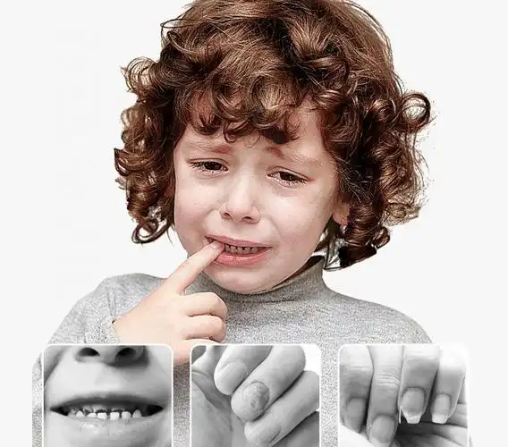 【宝宝戒吃手】 苦甲水儿童咬指甲防吃手神器小孩学生戒啃手纠正器