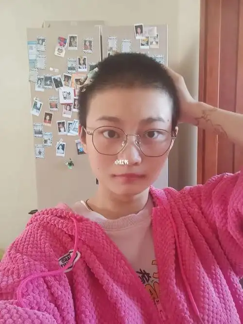 剃光头一个月可以别卡子了