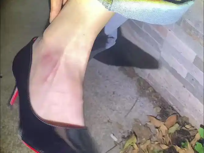 记录第一次高跟鞋崴脚日常,出去玩还是不要穿高跟鞋