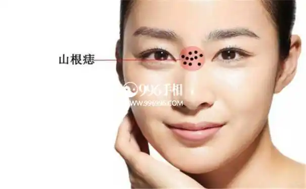 痣相山根有以下这些意义
