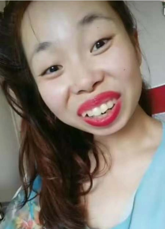 丑女嘟嘟姐回归网络,疑似整容,网友:曾经吓人如今美的不像话!