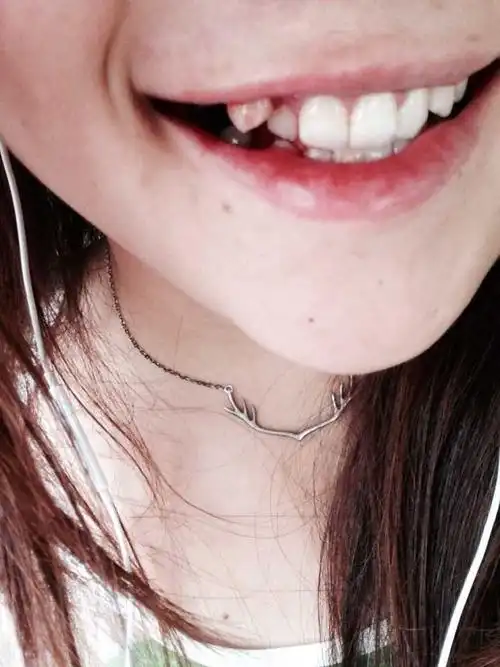 有虎牙是一种怎样的体验?