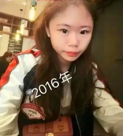 那个13岁就整容的网红女孩,3年整了60次,如今现状如何?