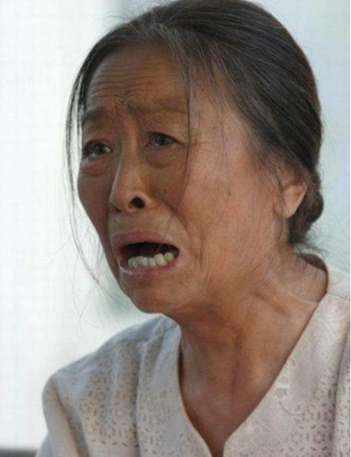 83岁丑娘张少华瘦成皮包骨说话气短无力健康状况堪忧