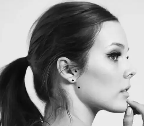 靠近耳朵的地方长痣好不好