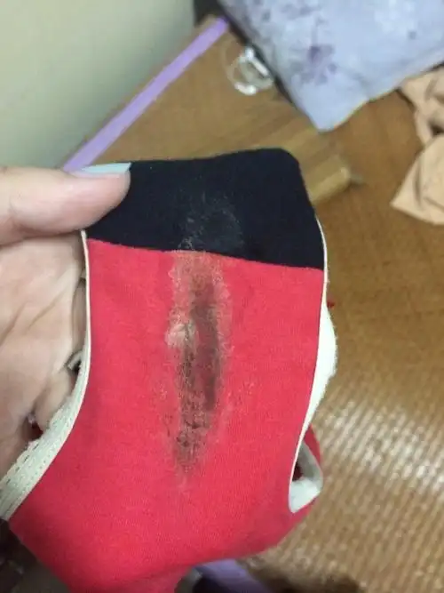 这两天短裤上都是这个 不知道是什么 恶心死了 想知道是什么东西.