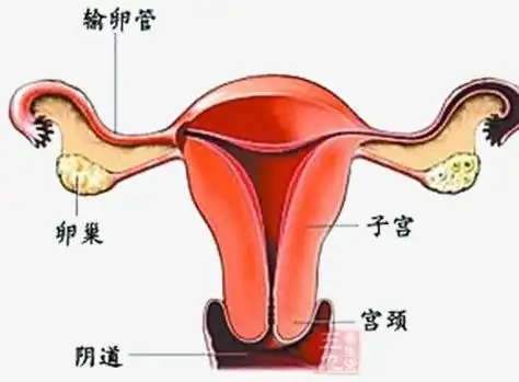子宫示意
