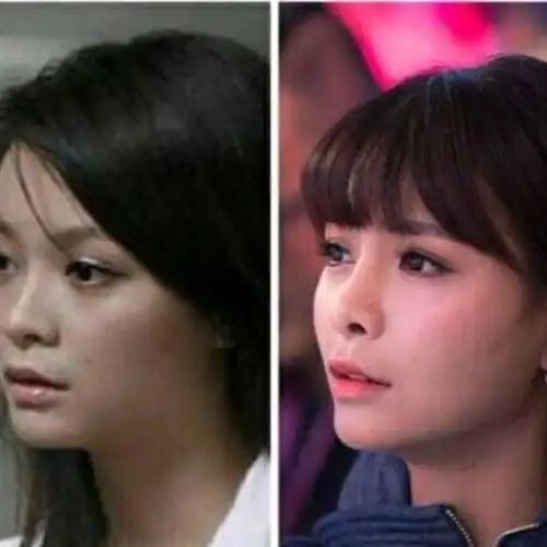 才发沈梦辰整容前沈梦辰整容呀 对比 前后沈梦辰整容对比痕迹沈梦辰