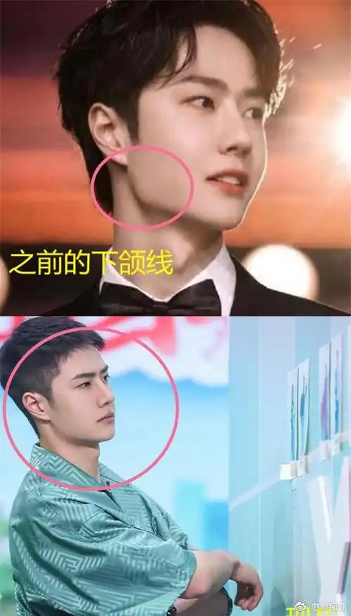 还不到25岁,王一博却开始"老"了,法令纹变深,下颌线变圆润