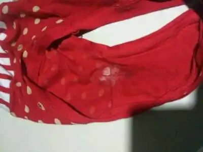 一天一换内裤每天晚上用水洗,可内裤上每天都有白色的东西,像渣似得?