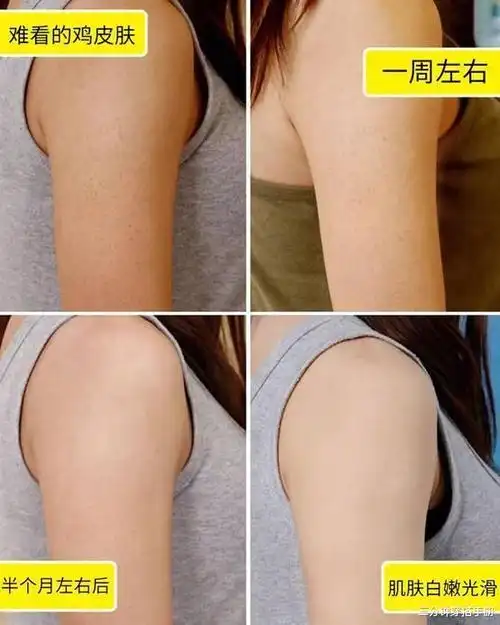 皮肤白皙光滑,谁看了不羡慕?