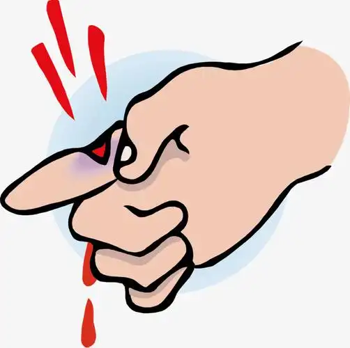 卡通手出血素材