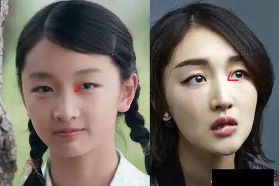 周冬雨割过双眼皮? 应该是没有整过容的