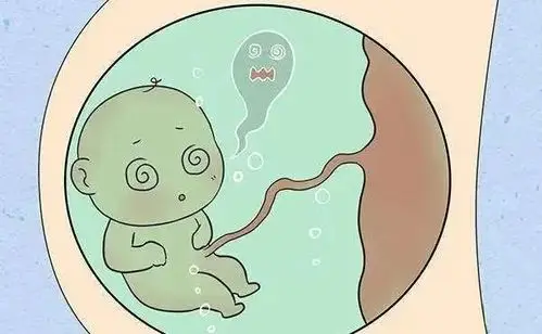 看赘婿笑破羊水真事儿这5种情况必须防