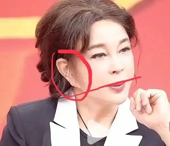 看完刘晓庆的耳朵,你还敢整容吗?