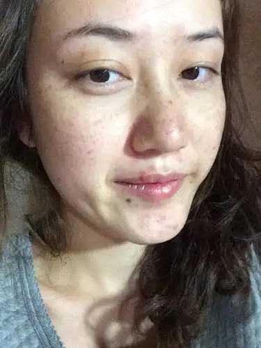 皮肤差到没朋友.