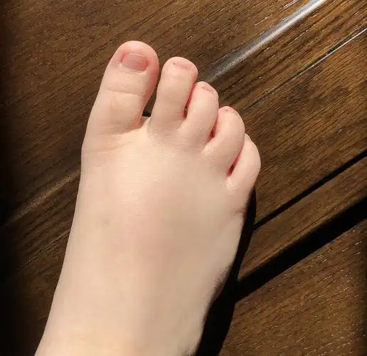 阳光下的脚丫没有指甲