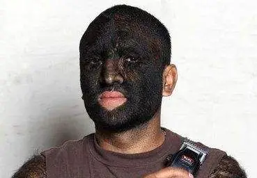 无论男女,2处体毛越多,身体往往越好,有人不懂珍惜,给刮掉了