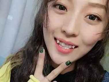 沈腾:老觉得没长虎牙,我这人就完美了