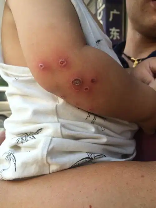 请问下大家,在医学里,小孩这种情况是怎么回事?