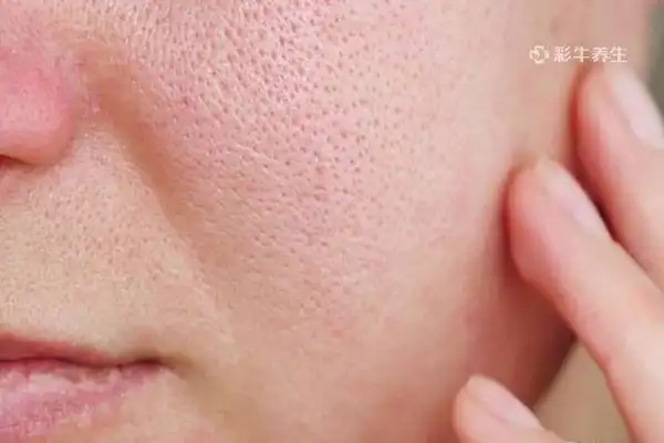 彩牛养生 养生常识 养生资讯 > 正文用冰块在脸上毛孔处敷上15—20