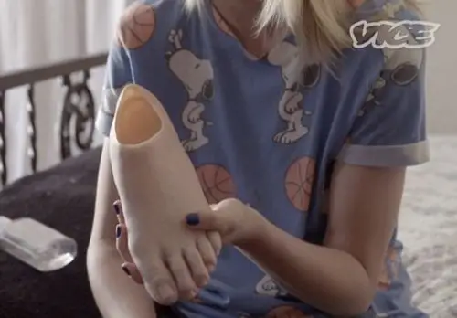 美模特患罕见疾病被截肢 戴假肢代言重获自信(组图)