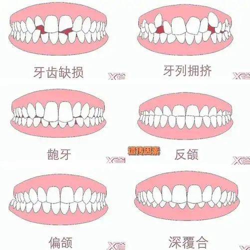 1 牙齿不齐如何引起的?